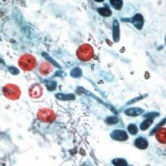 pathogens