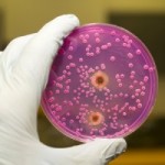 disease-petri-dish